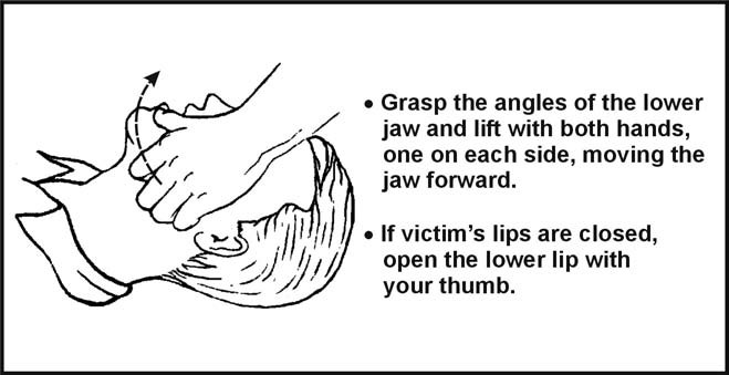 Figure 4-1. Jaw Thrust Method